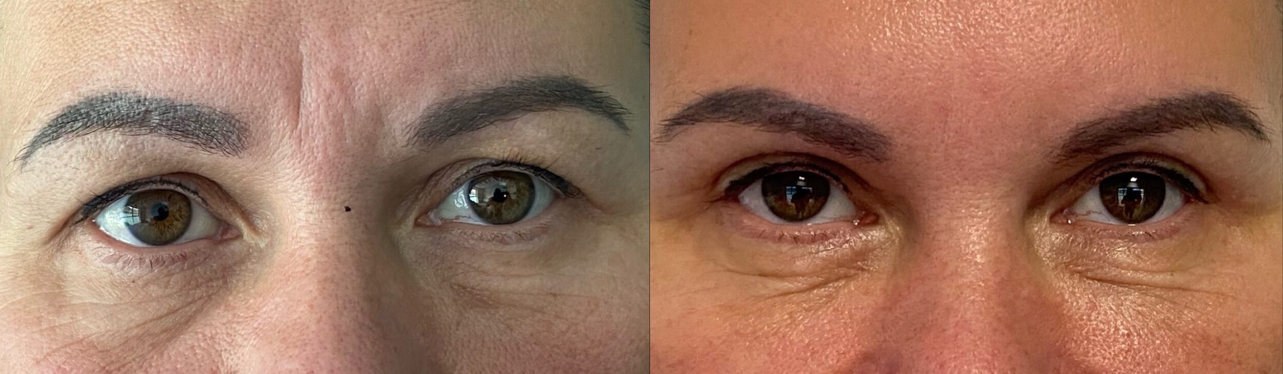 comparaison entre avant et après la chirurgie