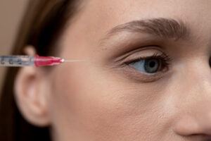 injection acide hyaluronique cerne creux dr koppe vienne lyon 