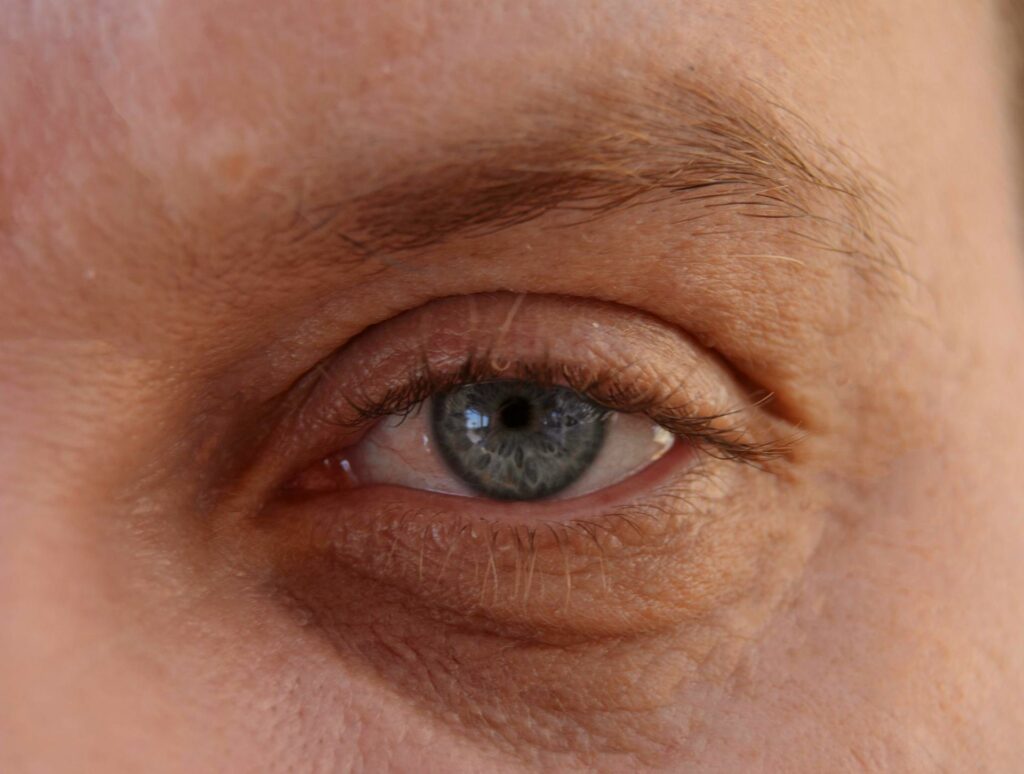 traiter le regard vieillissant