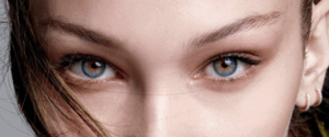 canthopexie quelles indications dr koppe lyon vienne fox eyes foxy cat's eye