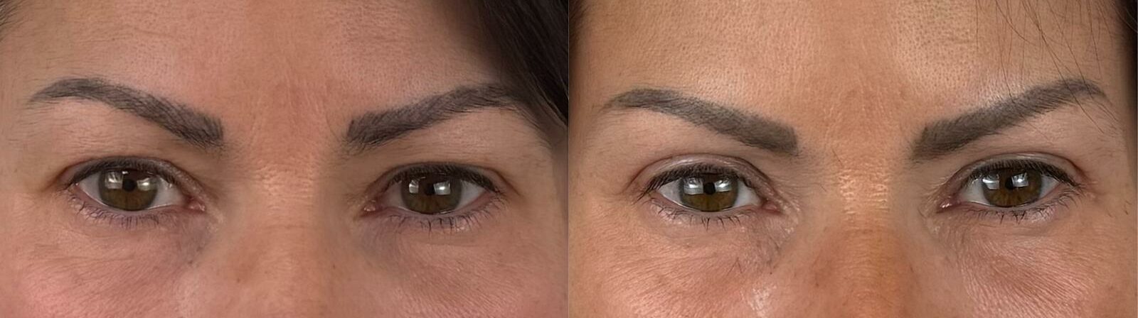 comparaison entre avant et après la chirurgie