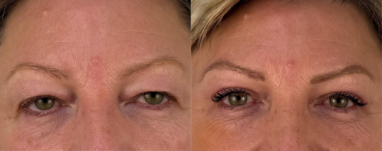 comparaison entre avant et après la chirurgie