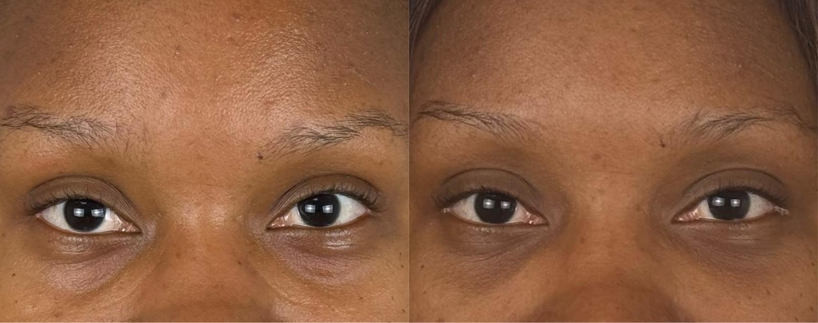 comparaison entre avant et après la chirurgie