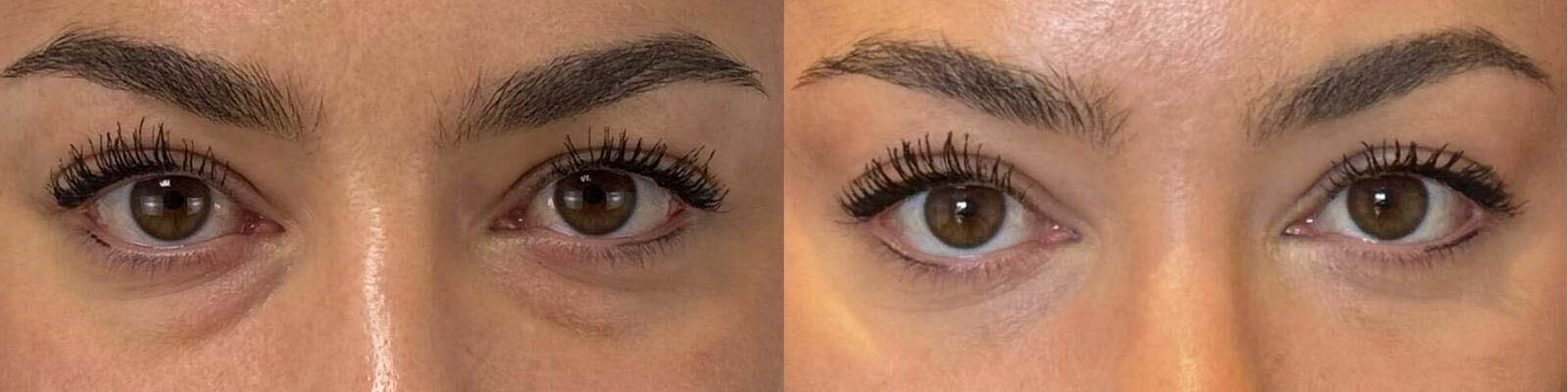 comparaison entre avant et après la chirurgie