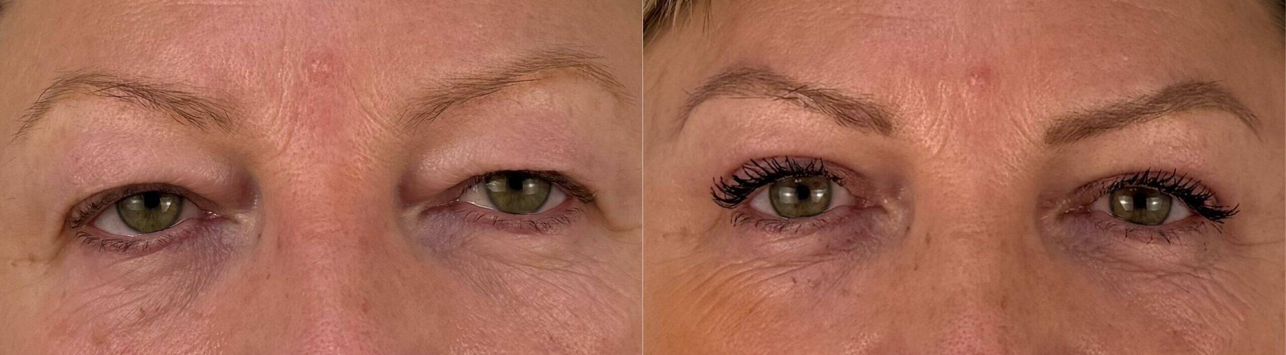 comparaison entre avant et après la chirurgie