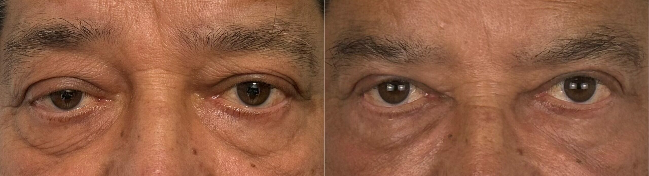 comparaison entre avant et après la chirurgie