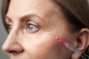 retirer injections acide hyaluronique blepharoplastie inferieure