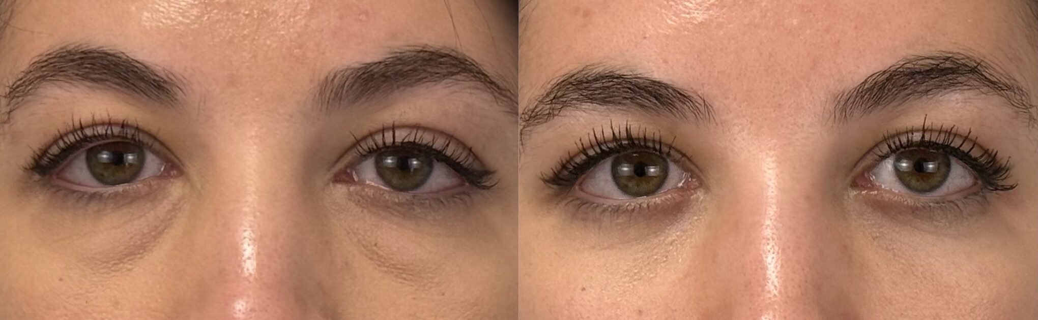 comparaison entre avant et après la chirurgie