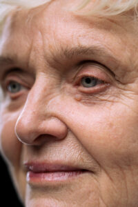 paupiere superieure qui se creuse avec le temps yeux enfonces que faire